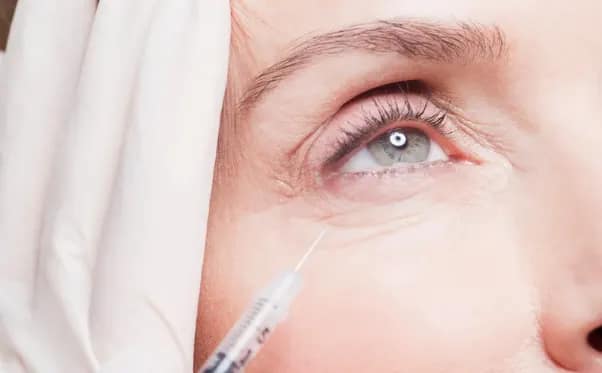 Under Eye Fillers: What to Know About Tear Trough Treatment